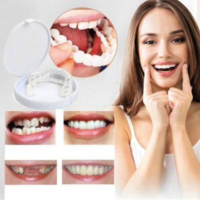 Snapon Smile Teeth Whitening Braces Set